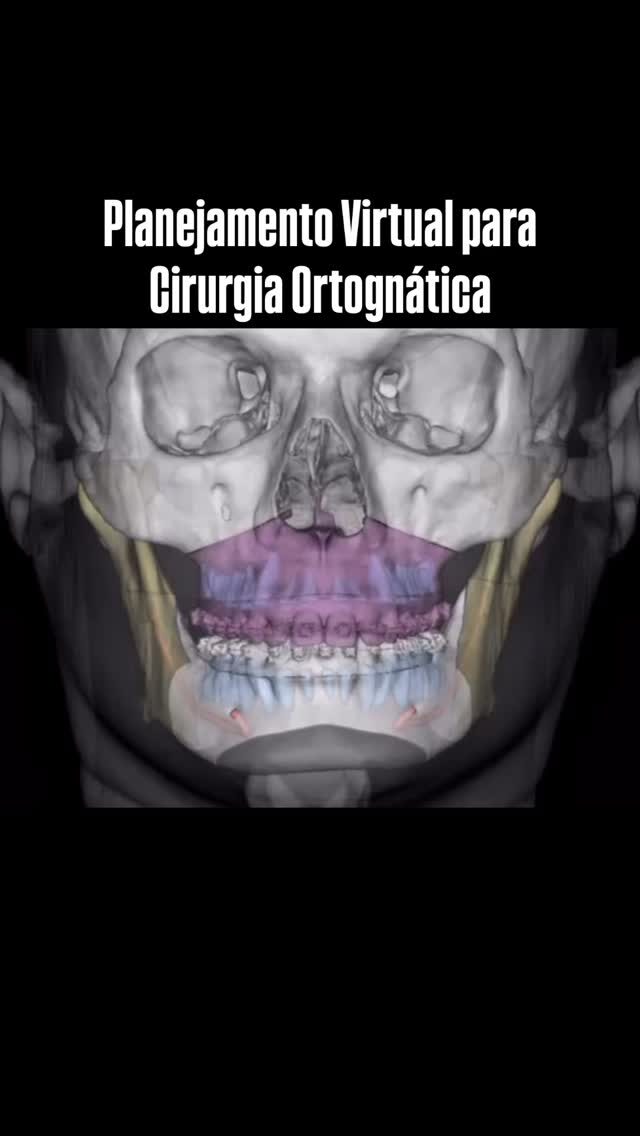 Instagram post from ortognaticaatmbelem. This post is in position 2.